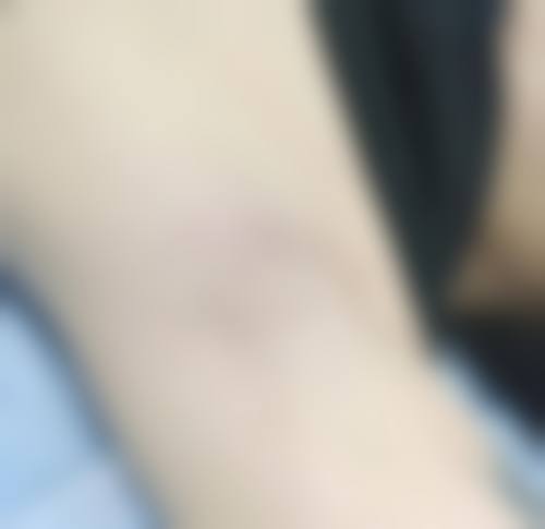 福州比华利医疗美容医院口碑怎么样:美丽见证好评