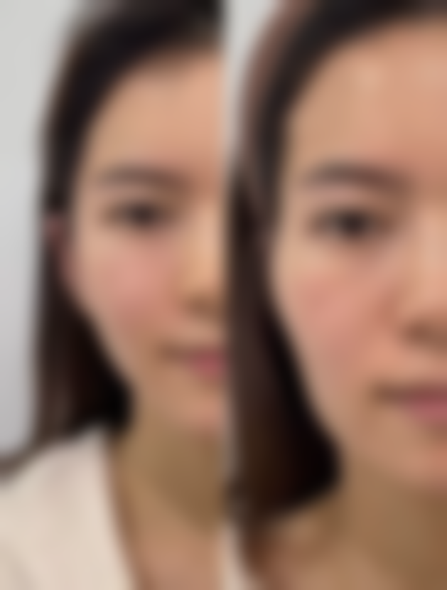 西安现代妇产医院美容科仪器设备
