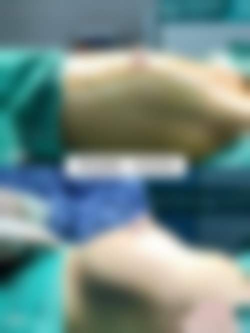 热门项目价格表与性价比分析