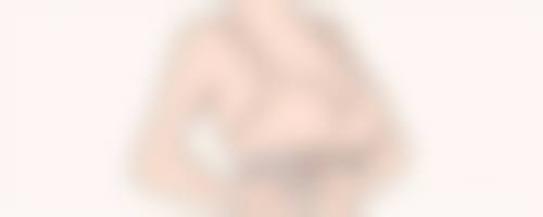 疤痕疙瘩治疗的优势与价格透明化解析