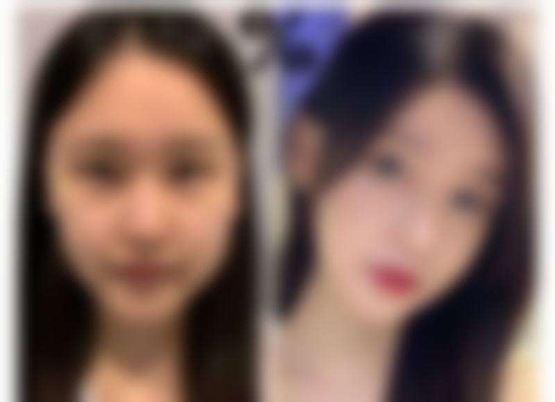 宾阳焯艺缇整形医院价格体系与性价比分析