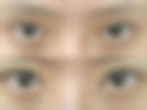 术后护理指导与长期健康管理