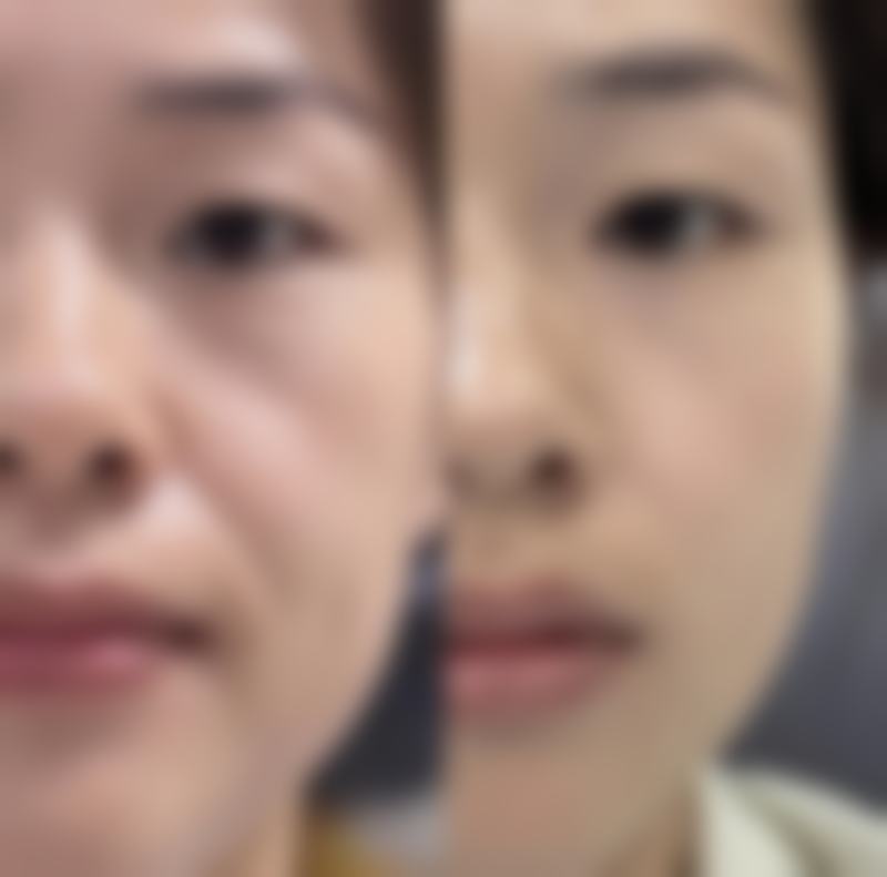 韩国有名眼科医美口腔医院中开展瘦脸针项目的优势分析