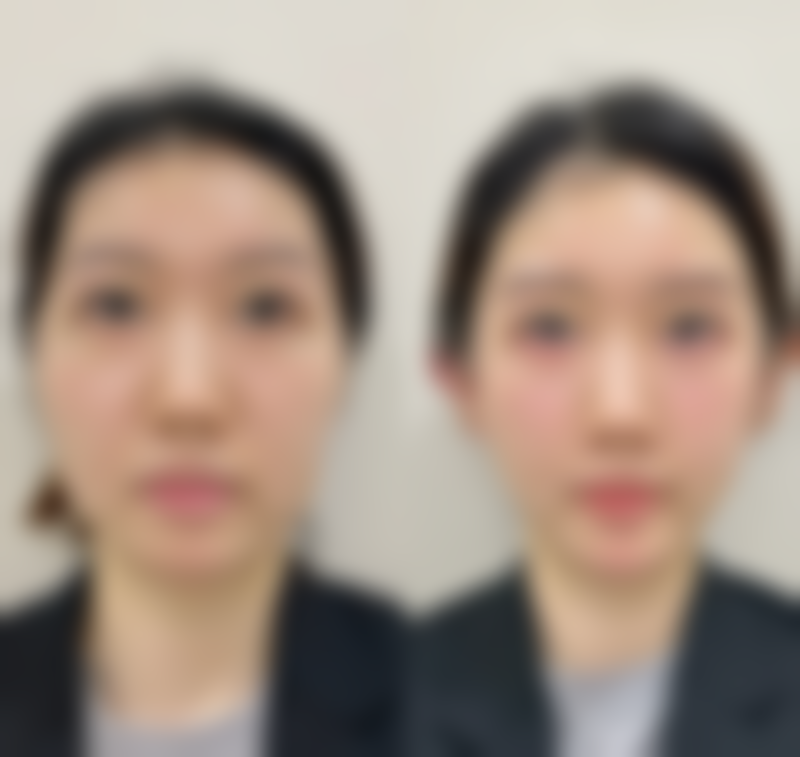 衡阳蓝鑫整形医院热门项目与价格解析
