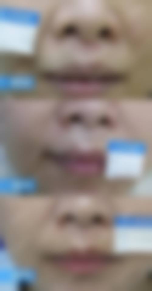 总结:为何泉州明韩医疗美容门诊部疤痕科是你值得信赖的选择