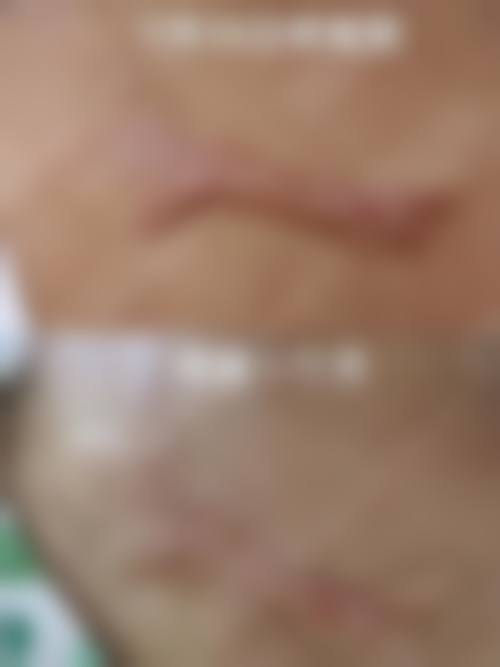 蒋欣凌医生的核心擅长项目与技术优势解析