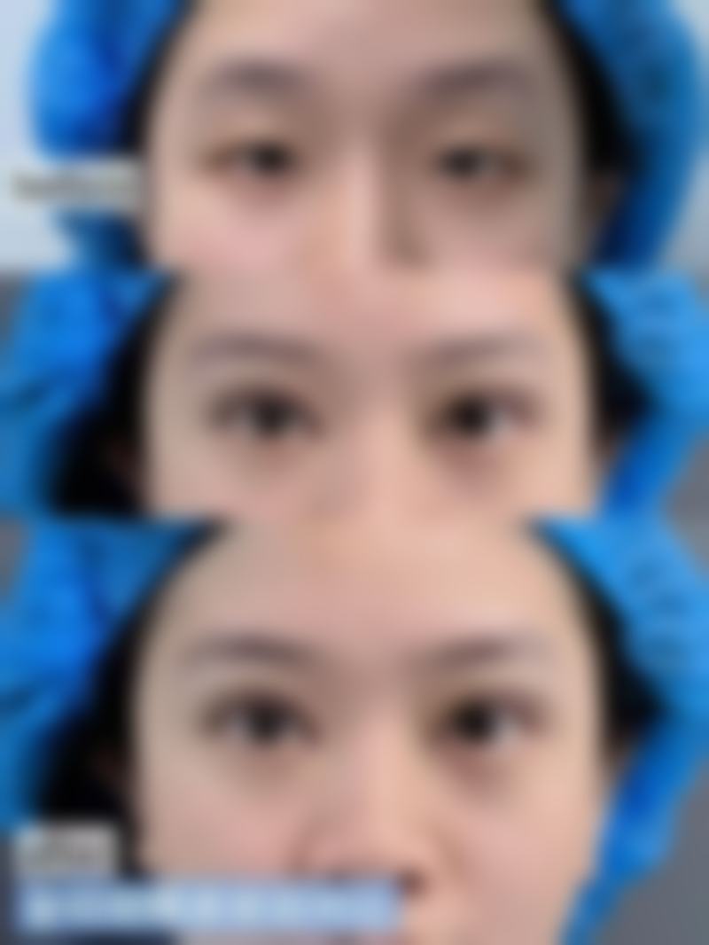 张娴医生在福州比华利医疗美容医院的定位与技术优势