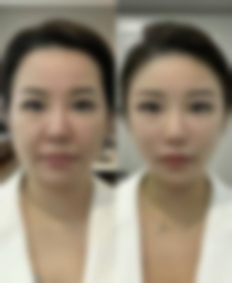 刘明刚擅长的核心整形项目及技术特色