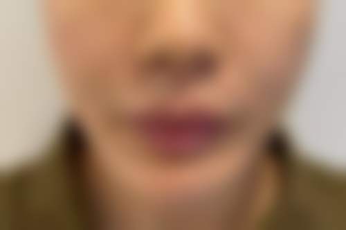 湖州鑫伊妍医疗美容门诊部湖州鑫伊妍(韩辰忆美)医疗美容门诊部