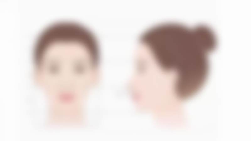 韩国可来熙Classy眼部手术实例实拍