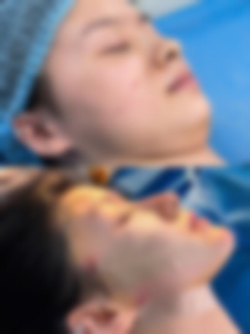 廖轶平预约攻略与广州美莱鼻整形中 心资质揭秘