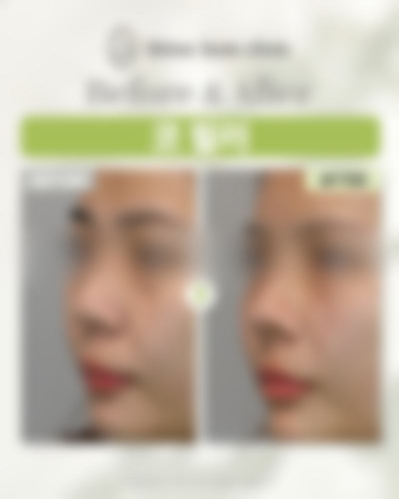 韩国shinebom皮肤科的价格体系与服务价值评估