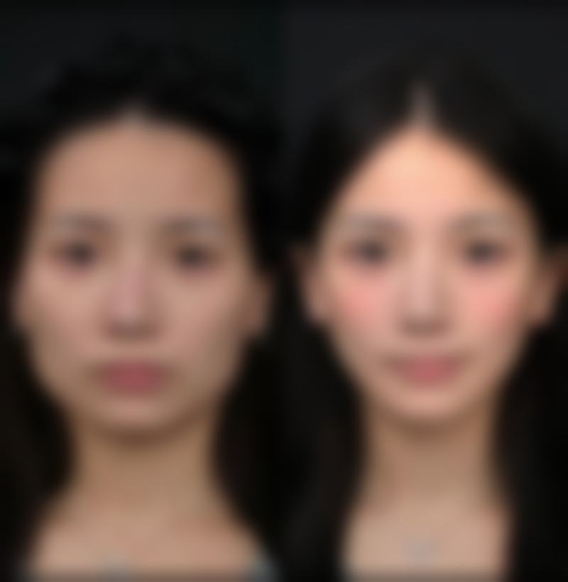衣笠美容外科 難波的术后管理与长期随访机制