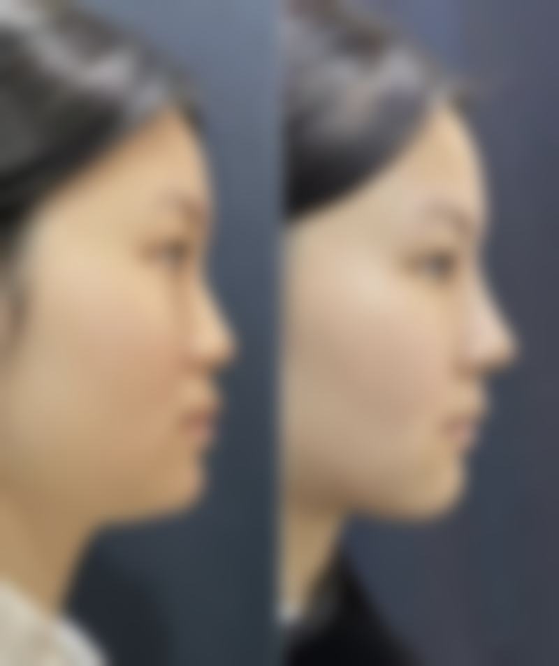 总结：为何衣笠美容外科 難波是您值得信赖的选择