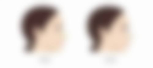 隆胸光面毛面哪个好？手感价格全解析