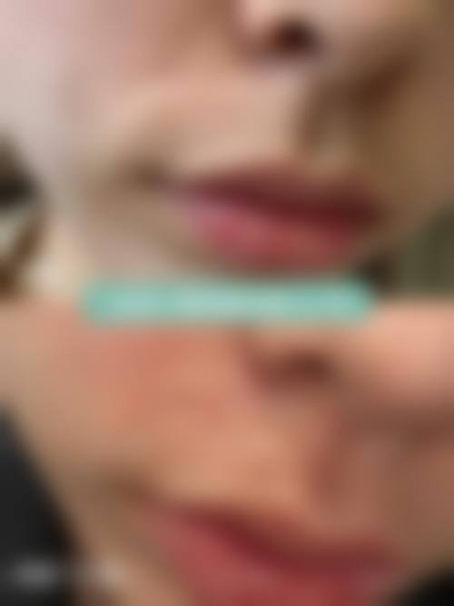 卢忠询的技术特色与诊疗理念
