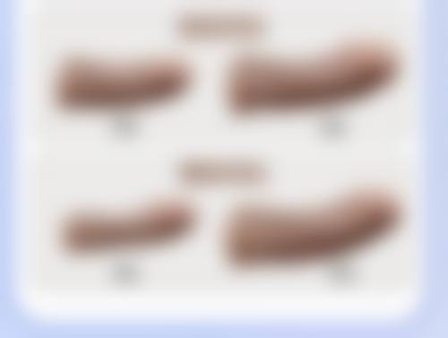 不同地区有名眼科医美口腔医院假体隆胸维权实例分析与应对策略