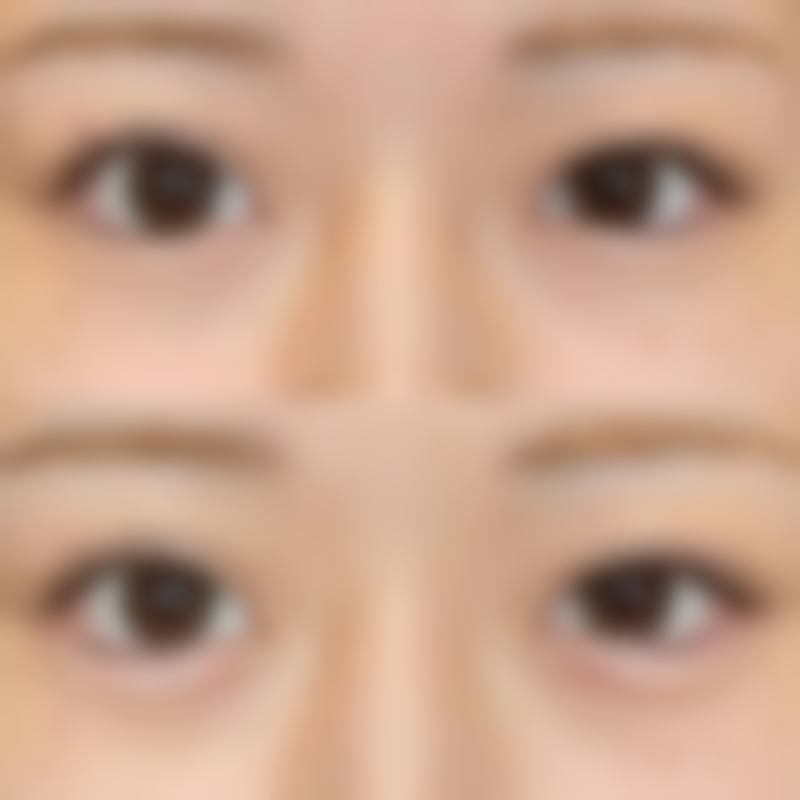 武汉美谛医疗美容门诊部热门项目深度解析