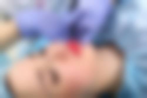 渼淳玉颜医疗美容核心技术解析：跨学科减张缝合与隐痕美学