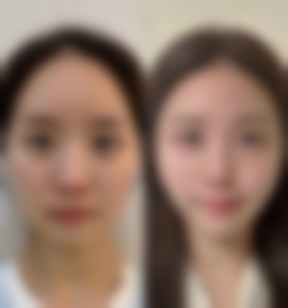渼淳玉颜医疗美容行业地位与未来展望：引领嘴唇整形精细化发展潮流