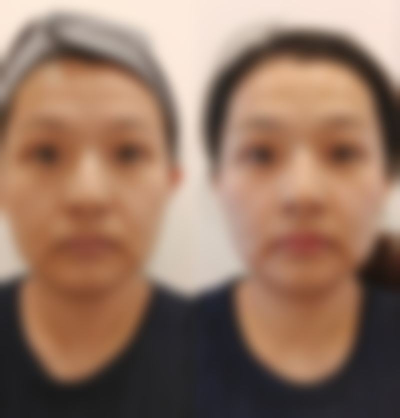 赵成杰擅长项目深度剖析:从激光美肤到轮廓精细化雕刻