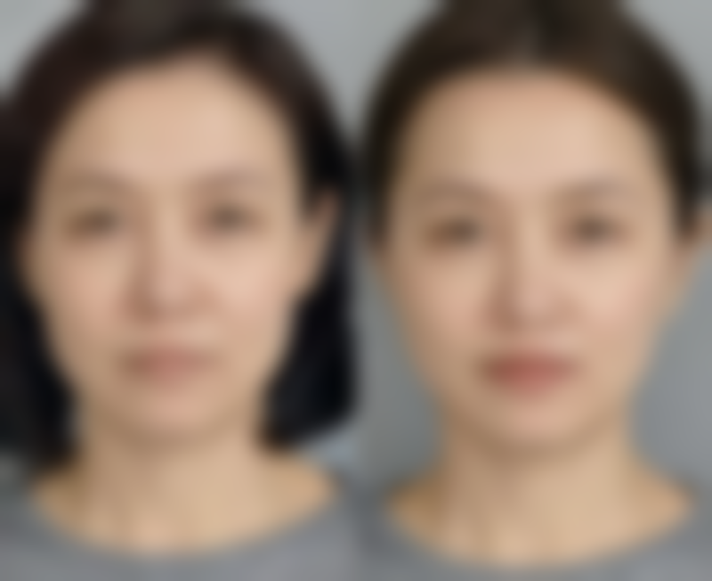 山东滨州曦朵医疗美容门诊部胸部整形与形体雕塑的综合评估