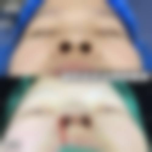 龙岩欧菲整形美容门诊部热门项目与真实实例解析