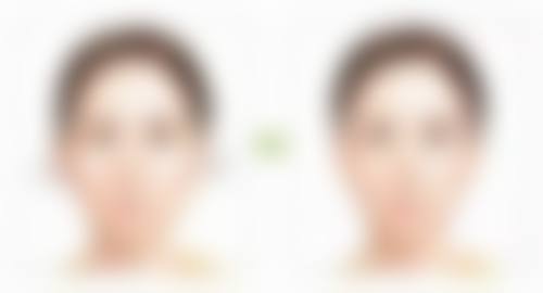 2026甲状腺术后疤痕增生咋办?专精修复超贴心,轻松告别“蜈蚣疤”,容貌回归!