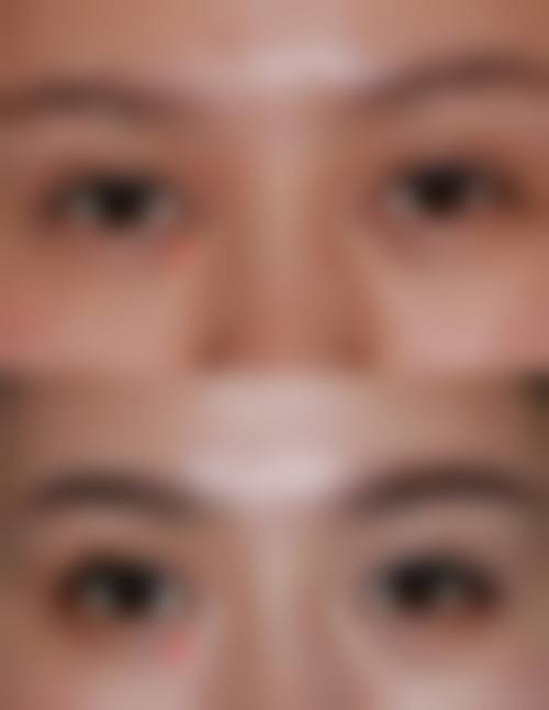 南宁伊美整形医院的价格体系透明度与服务体验