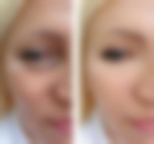 总结:为何选择南宁伊美整形医院是你的明智之举