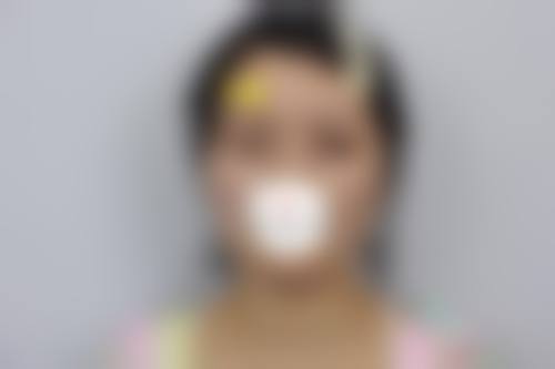 南宁伊美整形医院特色项目深度解读:从眼鼻精细化雕刻到皮肤抗衰