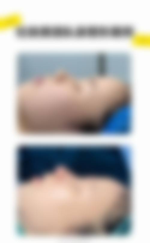 南宁伊美整形医院的真实实例反馈与口碑建设