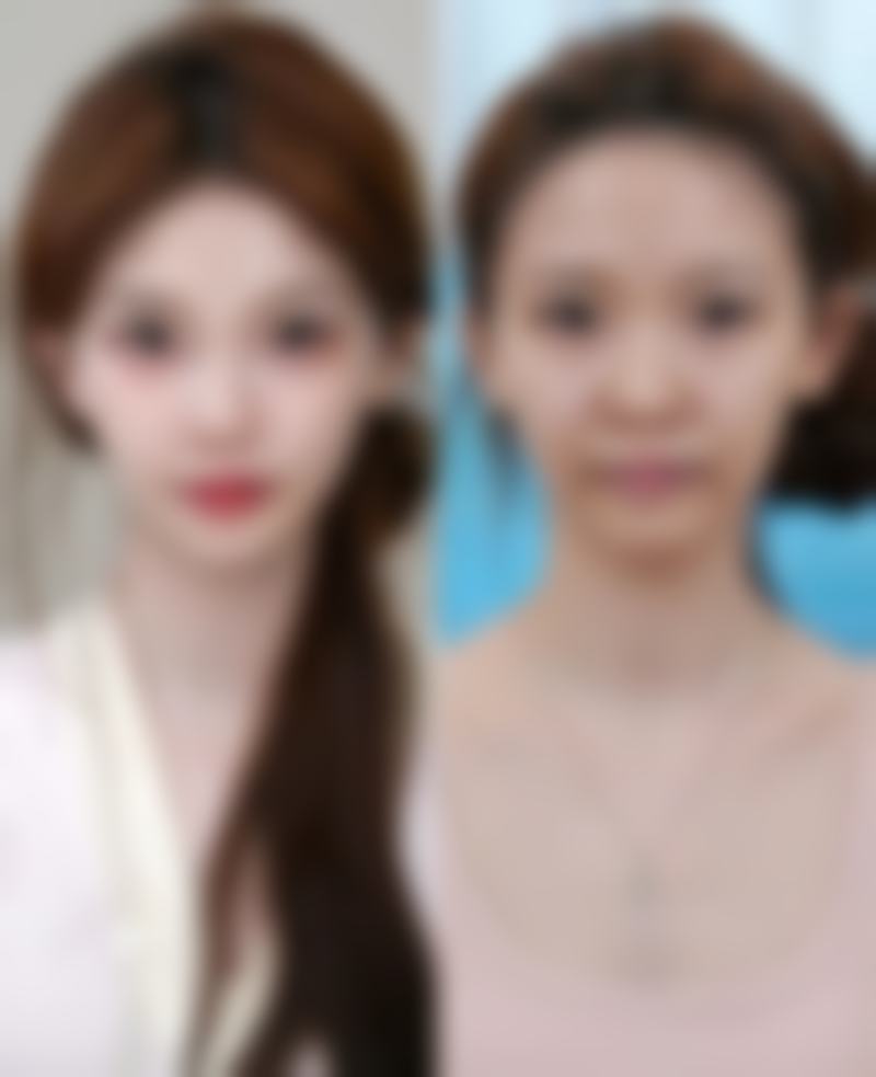 雅安斯卡娣美医疗美容门诊部热门项目解析