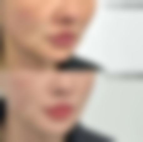 总结：为什么选择济南合美医疗美容门诊部？
