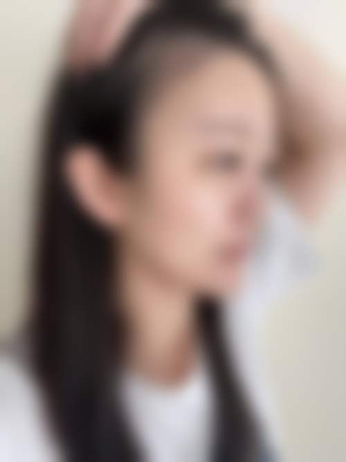 罗田田医生的专精技术体系与核心优势