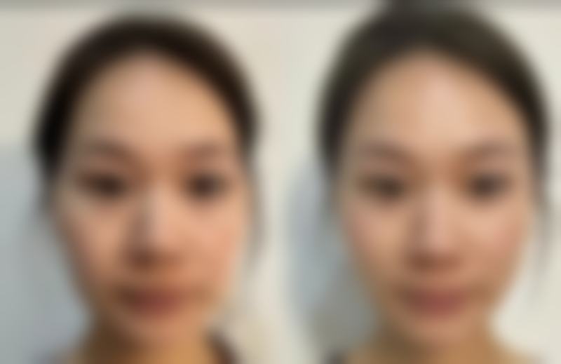胶州第三人民医院整形科真实实例分享与用户评价