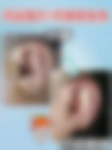 冰点微痛更舒适