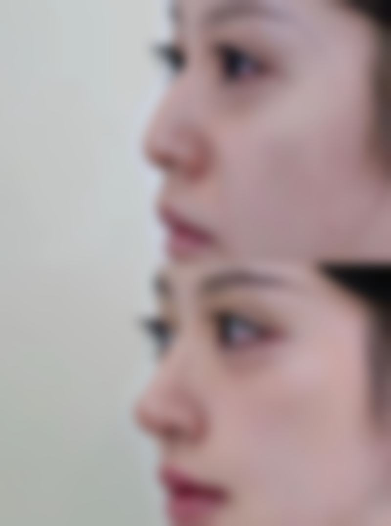 心脏不好能做眼袋手术吗:2026年新技术与新趋势如何提升安心性